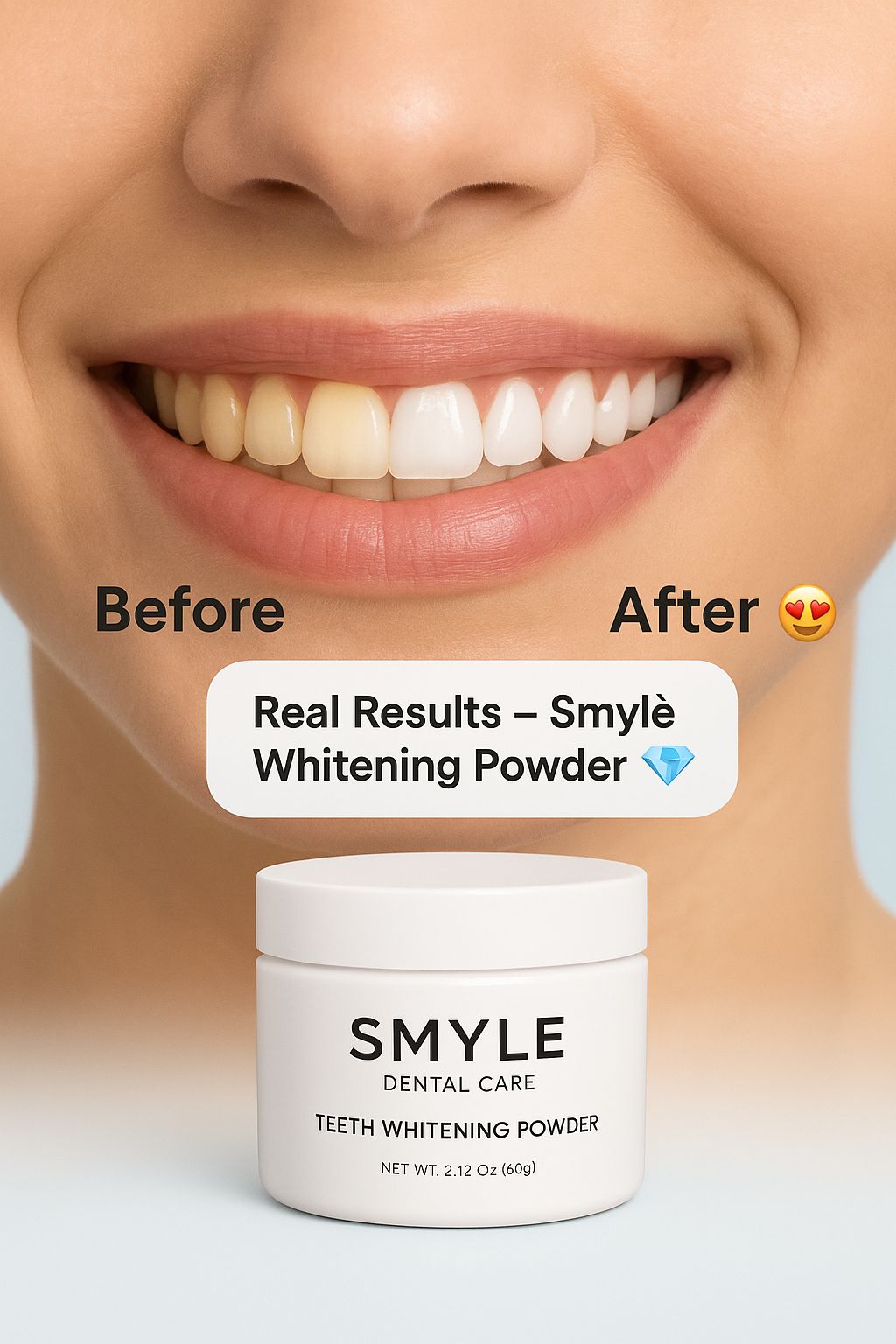 Smylè Natural Teeth Whitening Powder
