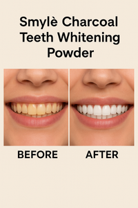 Smylè Natural Teeth Whitening Powder